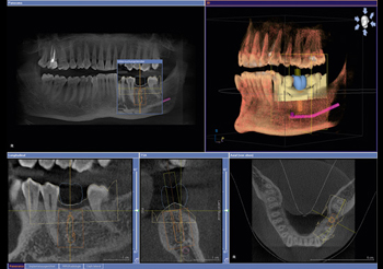 orthophos-top-surgical-procedures